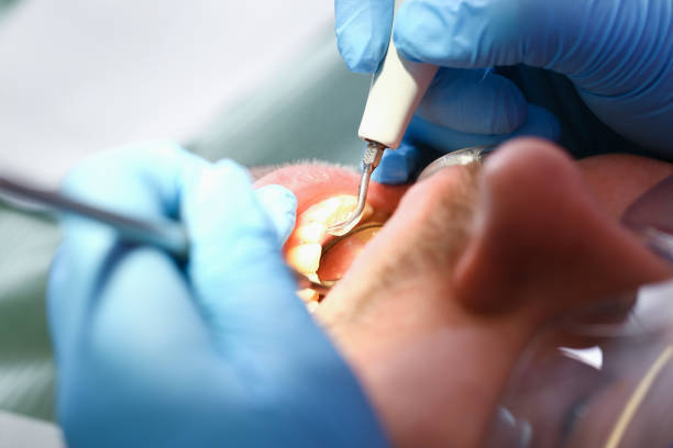 Best Same-Day Emergency Dentist in Dovesville, SC
