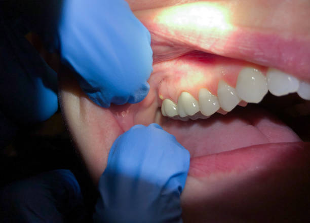 Best After-Hours Emergency Dentist in Dovesville, SC