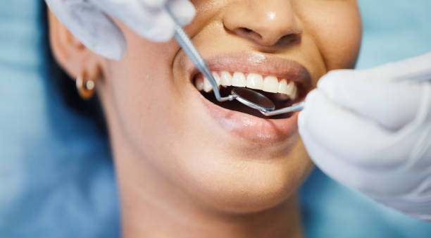Best Emergency Broken Tooth Repair in Dovesville, SC